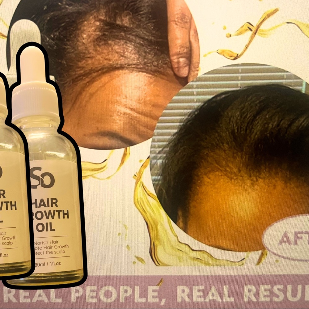 Hair Growth Oil